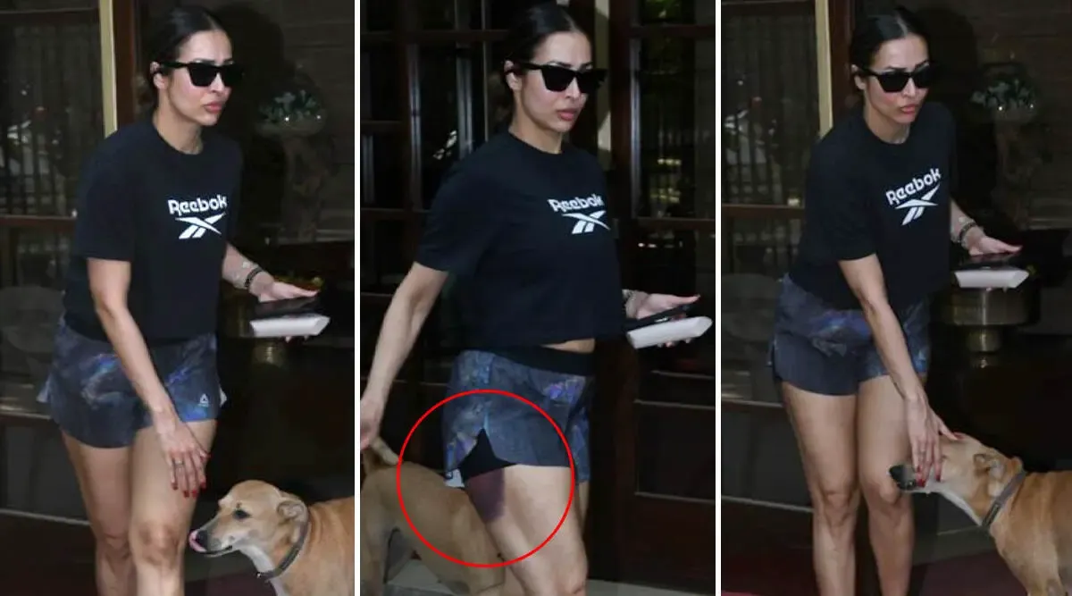 Malaika Arora Suffers Brutal Injury, Video Goes Viral