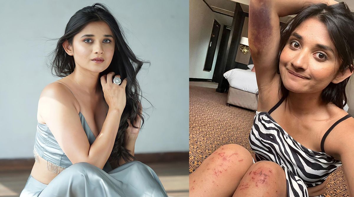 Kanika Mann flaunts her injuries; calls them her new ‘trophy'