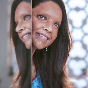 Chhapaak Still